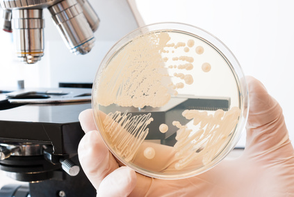 lab doctor holding a bacteria film in front of a microscope